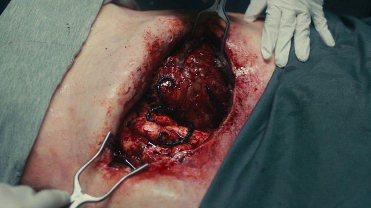 Dead Reset, Steam Gift